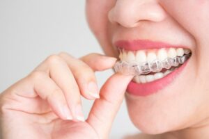 Family Orthodontist in Leawood