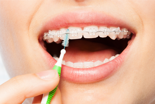  Cavity Treatment in Overland Park 