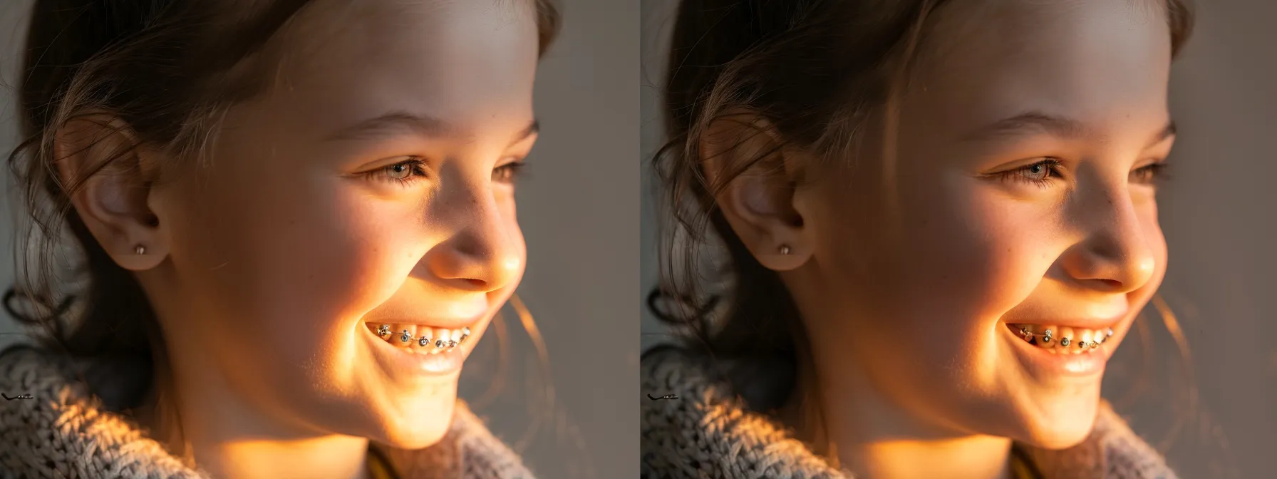 a smiling child with clear braces, showcasing their discreet and innovative orthodontic treatment.