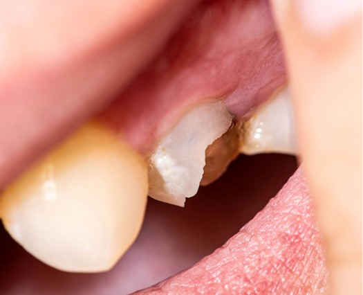 Tooth Pain in Prairie Village