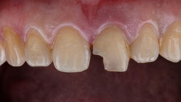 Tooth Pain in Prairie Village