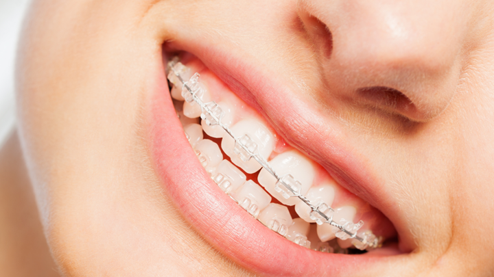 Teen Orthodontist in Leawood