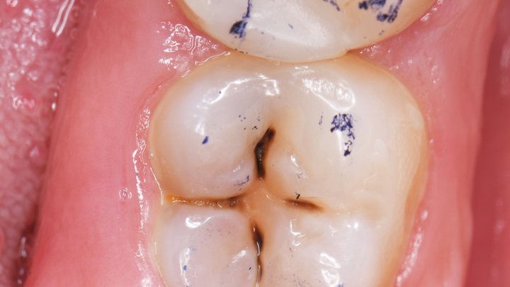 Tooth Pain in Prairie Village