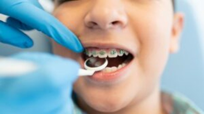 crowded teeth orthodontist in Overland Park
