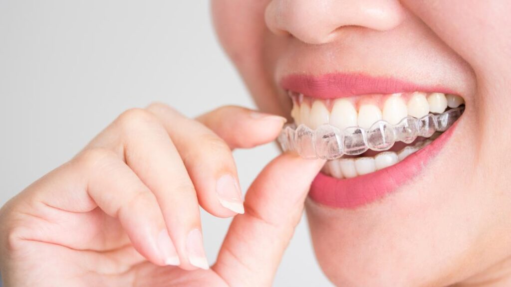 Invisalign in Overland Park