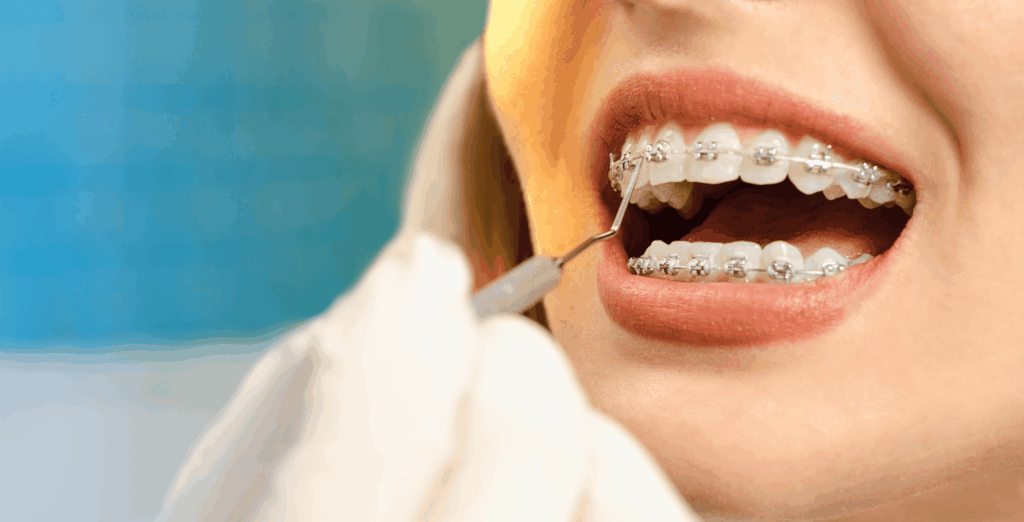 Clear Braces in Leawood