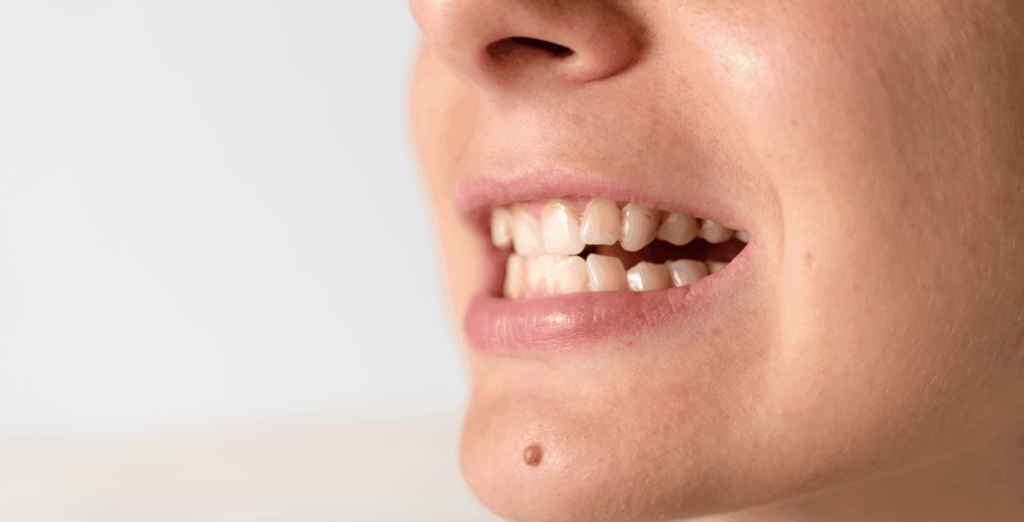 Crooked Teeth Orthodontist in Prairie Village