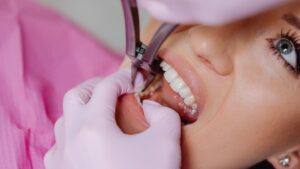 frenectomy in Overland Park 