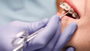 pediatric orthodontist in Overland Park