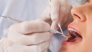 cavity treatment in Prairie Village