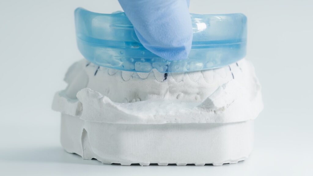 dental mouthguards in Prairie Village