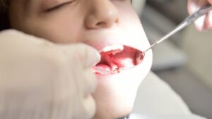 lip tie in Bonner Springs