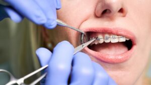 Clarity by 3M in Bonner Springs