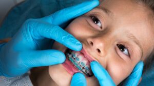 metal braces in Bonner Springs
