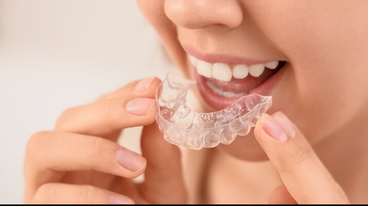 Sports Dentist in Bonner Springs