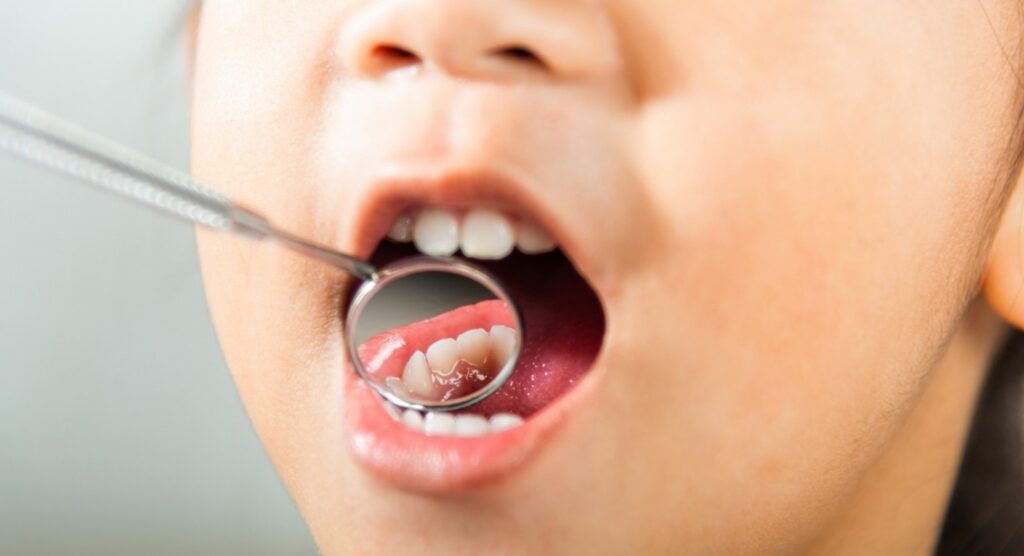 Tooth Pain in Bonner Springs