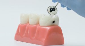 Cavity Treatment in Bonner Springs