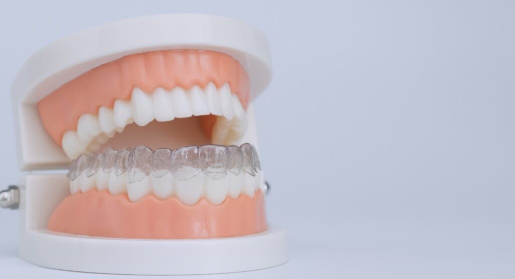 Invisalign in Overland Park