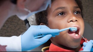 Tooth Pain in The Legends